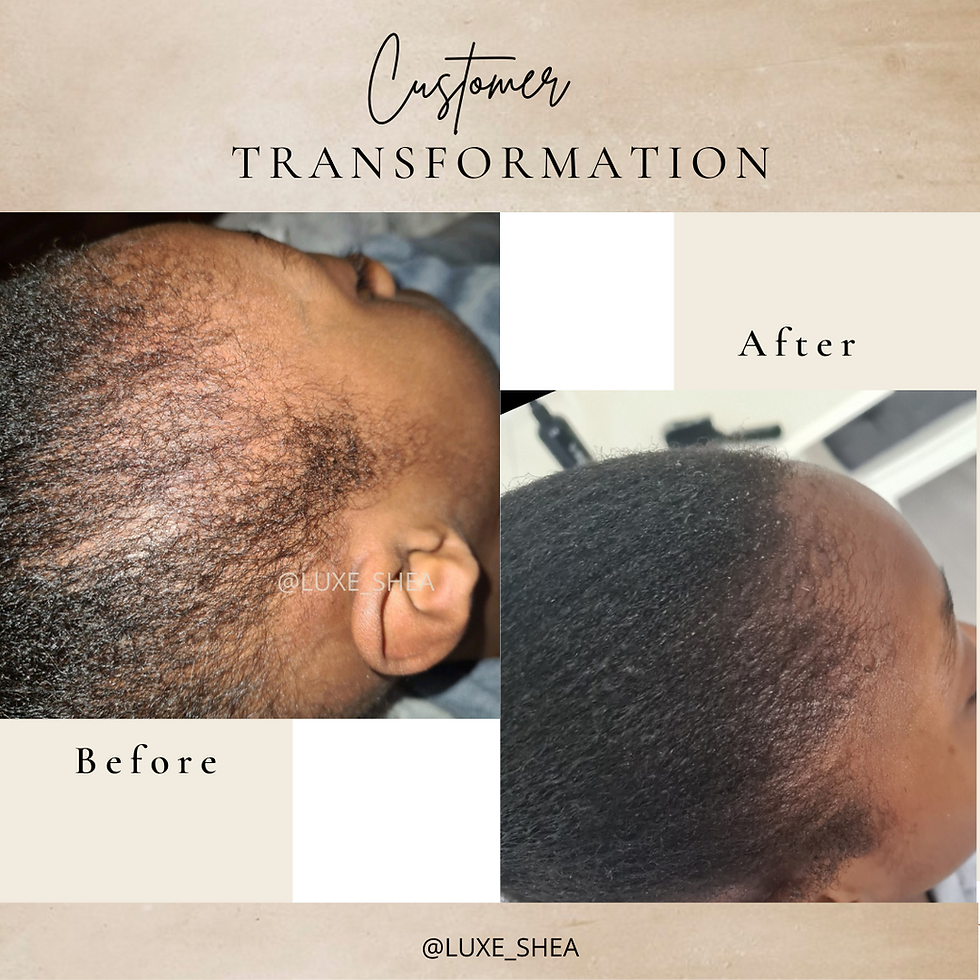Thumbnail: Hair mist & Growth oil, Detangling brush