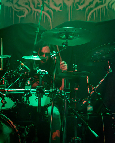 Organectomy performing in Winnipeg.