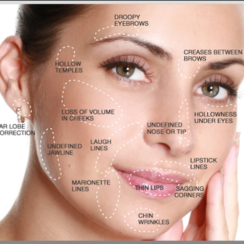 Understanding Vascular Risk Zones in Injectables: Patient Awareness in Salem, Oregon