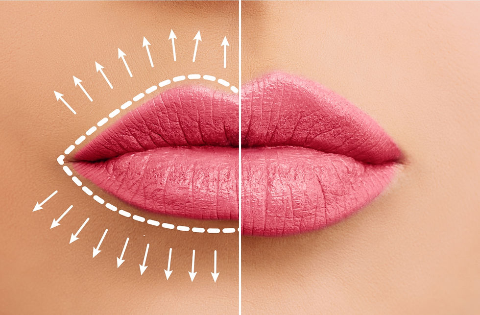 lip-flip.jpg