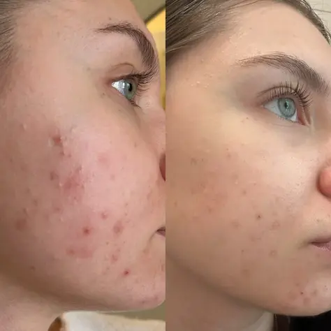 How to Identify Overtreatment Before It Happens in Aesthetic Patients in Salem, Oregon