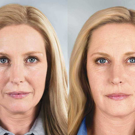 The Shift from Correction to Preservation in Modern Aesthetics in Salem, Oregon