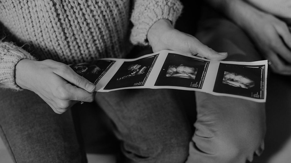 Article illustration