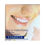 Thumbnail: High-tech Dental Braces Care Kits 