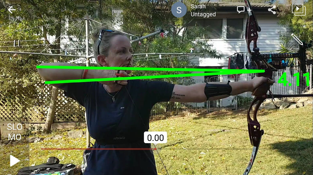 Single case study elbow picture