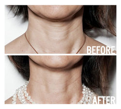 karen-before-and-after.jpg