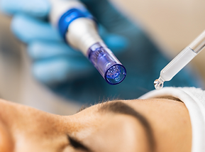 Microneedling Facials for Anti-Aging and Collagen Induction Therapy