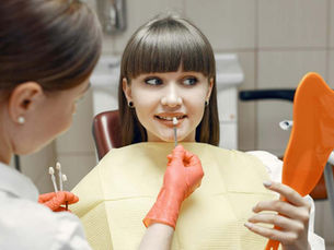 common veneer faliures