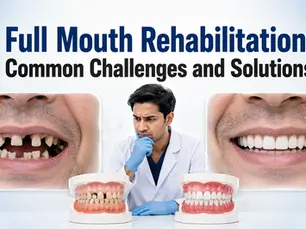 Full Mouth Rehabilitation: Common Challenges and Solutions