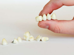 Crown and bridge course in Delhi