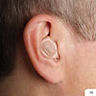 Ear with In The Ear Hearing Aid