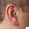 Ear with Completely in Canal Hearing Aid