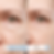 PRF Treatment for face in Orlando Before and After