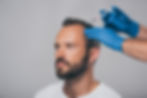 PRF Hair Treatment for men in Orlando