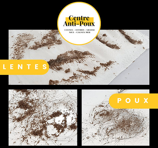 AvantAprès et PouxLentes (4) (1).png