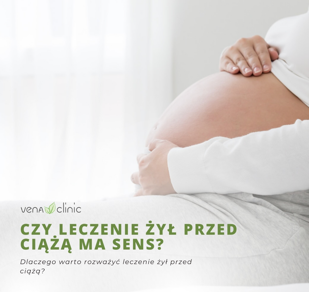Czy leczenie żył przed ciążą ma sens?