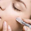 microneedling1_600x600.webp
