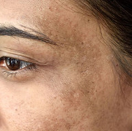 8 Common Skin Problems and How to Fix Them.jpg