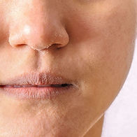 Dry Vs Dehydrated Skin_ Tips and Skin Care Routines to get rid of them - Superloudmouth.jp
