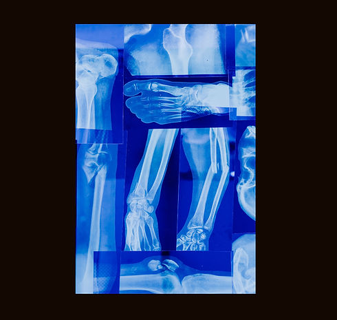 xray_edited.jpg