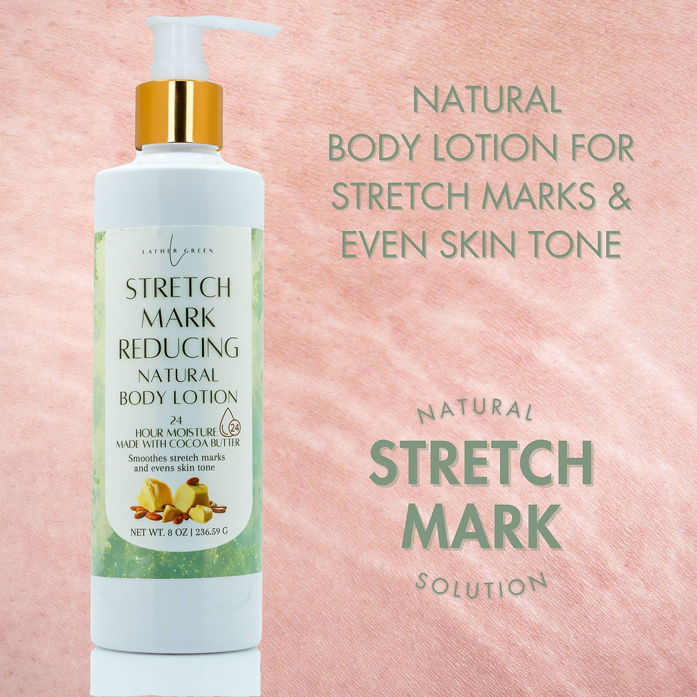 Thumbnail: Stretch Mark Reducing Natural Body Lotion