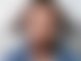 FUE vs DHI vs QHT Hair Transplant in Hyderabad - Which Technique Should You Actually Choose?