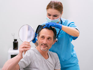 Hair Transplant in Hyderabad: Building Confidence, Managing Expectations, and Owning the Long-Term Journey