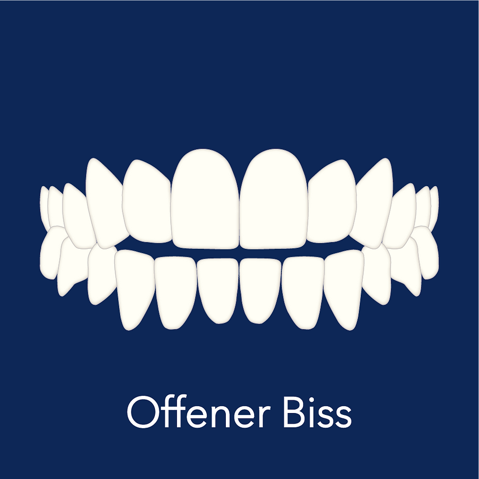 Offener Biss