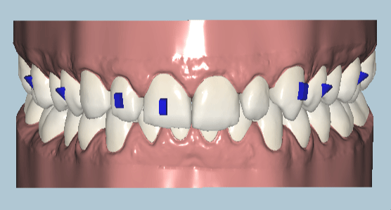 TG1KG_advanced.gif
