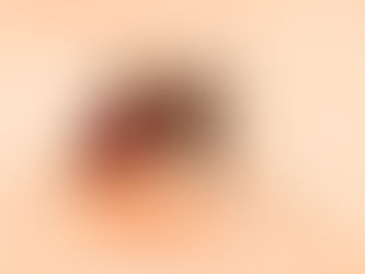 Puebla refuerza llamado a acudir al médico ante síntomas de dengue