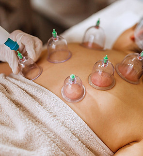 16554-cupping-therapy.jpg