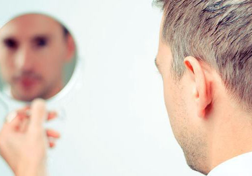 E quando a calvície começa entre os homens