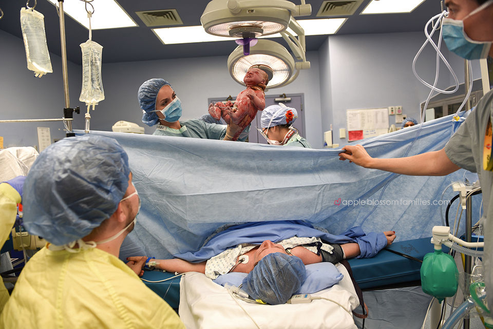 family centered cesarean