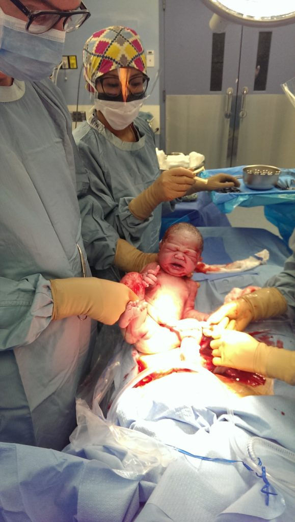 Birth