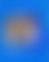 Entrevista no canal Viver Bem: Cirurgia Robótica do Joelho