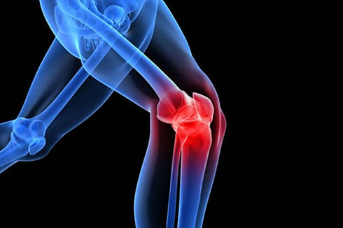 cirurgia do joelho joelho.jpg