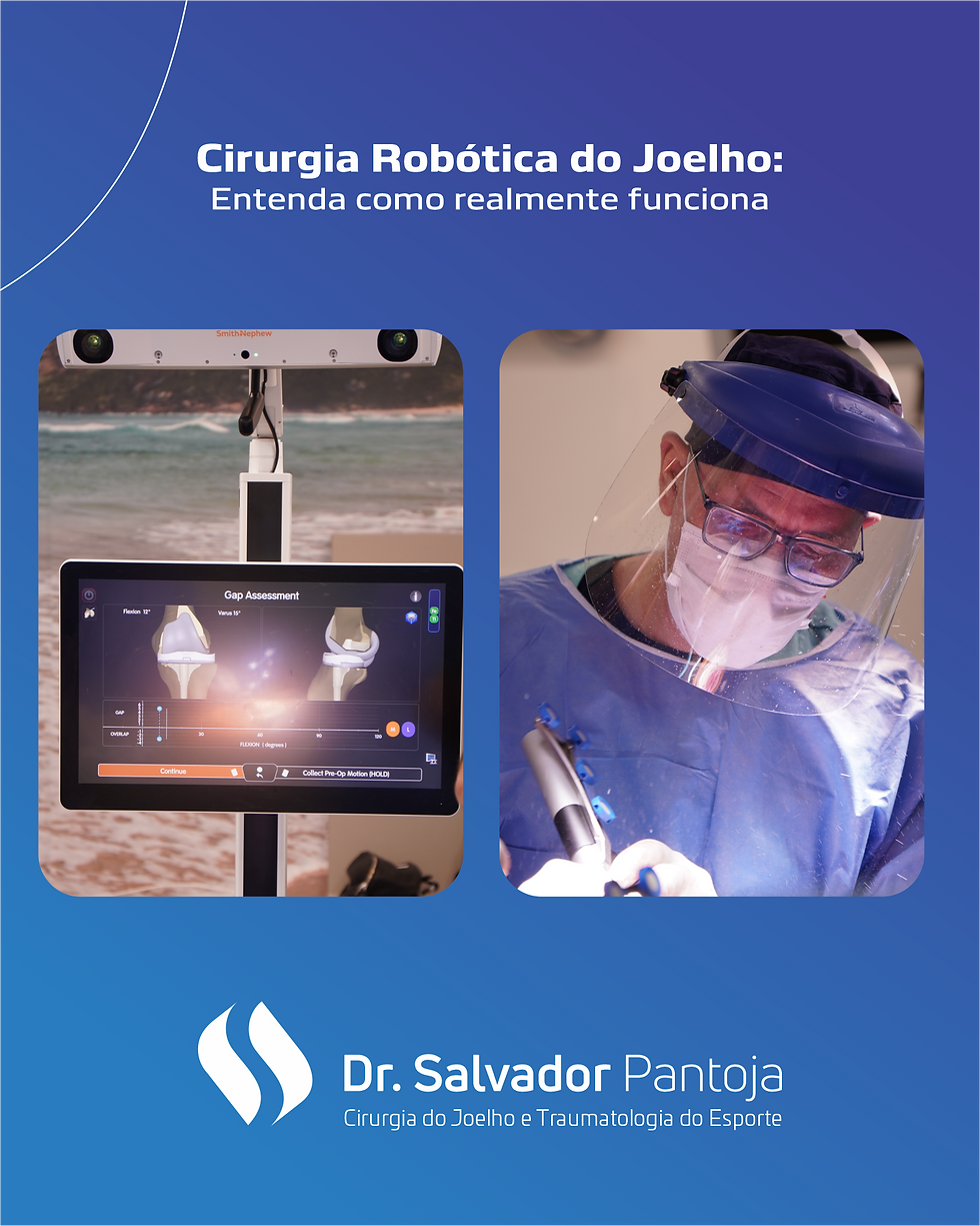 Cirurgia Robótica de Joelho: Entenda como realmente funciona