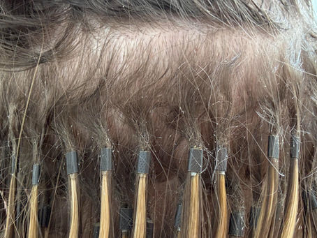 Hair Weaving Side Effects