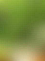 Սնվեք և նվազեցրեք այտուցը. սննդաբանը անվանել է ավելորդ ջուրը հեռացնելու անվտանգ մթերքներ