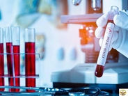 Արցախում կորոնավիրուսային հիվանդության 13 նոր դեպք է գրանցվել