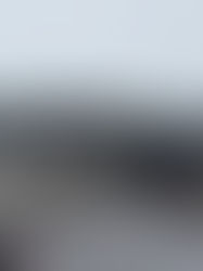 ՆԳՆ ավտոբուսի և թեթև մարդատարի վթարից տուժածները դուրս են գրվել ԲԿ-ից