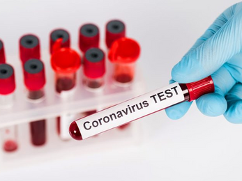 Արցախում կորոնավիրուսային հիվանդության 91 նոր դեպք է գրանցվել․ 20 հիվանդի վիճակը ծայրահեղ ծանր է