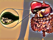 5 ամենավտանգավnր մթերքները, որոնց պատճառով լեղապարկի քարերն ավելանում են