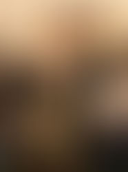 Viva-ի աջակցությամբ «Զինվորի տուն» վերականգնողական կենտրոնը ձեռք է բերել ուրոլոգիական էնդոսկոպիկ գործիքակազմ