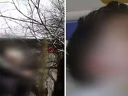 Հունվարի 22-ից մարտի 10-ը ծեծի են ենթարկել 1 տարեկան երեխային. մանրամասներ` ահասարսուռ դեպքից