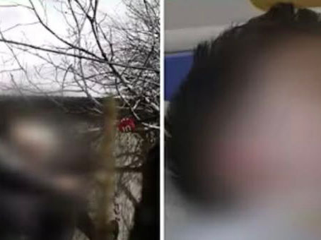 Հունվարի 22-ից մարտի 10-ը ծեծի են ենթարկել 1 տարեկան երեխային. մանրամասներ` ահասարսուռ դեպքից