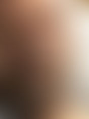 Մանրամասներ Խաչատուր Հունանյանի վիճակից