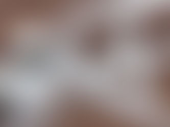 Բժիշկը զգուշացրել է, թե ինչ հիվանդություններ կարող է առաջացնել աղի ավելցուկը