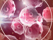 Քաղցկեղի թոփ 3 մահացու տեսակները. նշվել է ամենավտանգավnր տեսակները