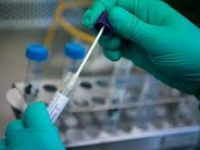 Հոկտեմբեր  ամսին Հայաստանում գրանցվել է  COVID19-ից մահերի ամսական ռեկորդային ցուցանիշ